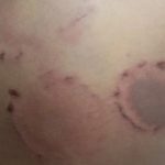 Criança morre após cair em caixa d’água em Itapecuru-Mirim