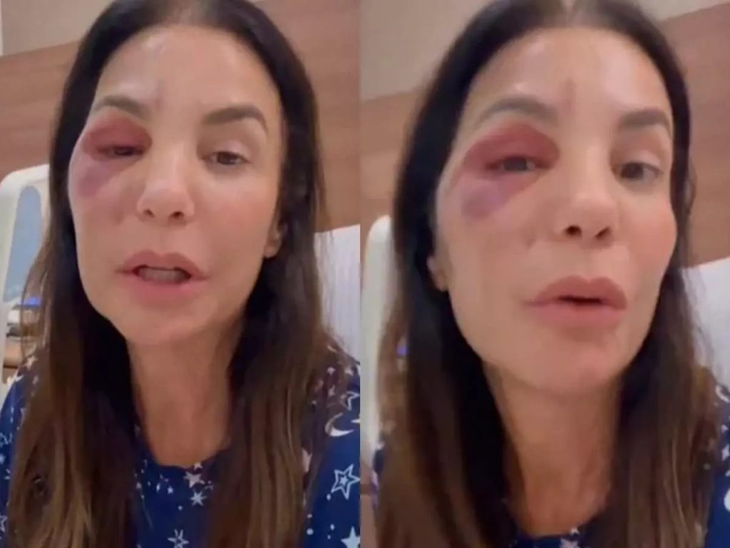 Cantora Ivete Sangalo rebate rumores de agressão após cirurgia