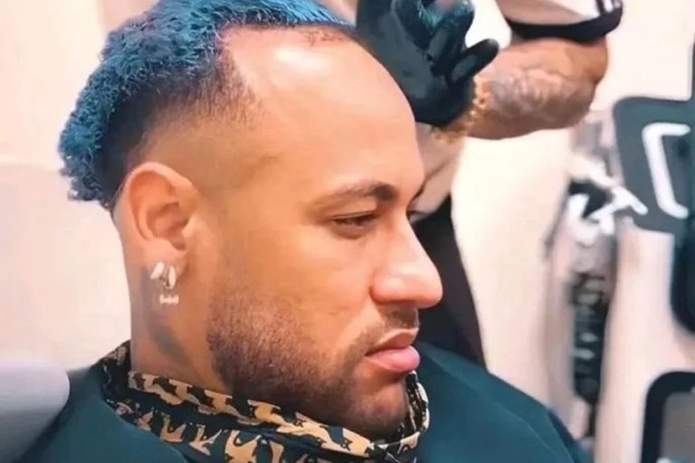 Especialistas comentam calvície após repercussão de fala de Piovani sobre Neymar