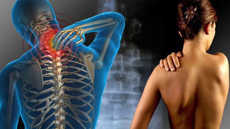 Fibromialgia afeta até 3% dos brasileiros e agora é considerada deficiência