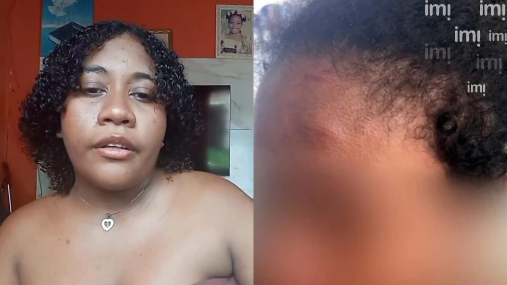 Empregada doméstica afirma ter perdido parte da audição após agressões no Maranhão
