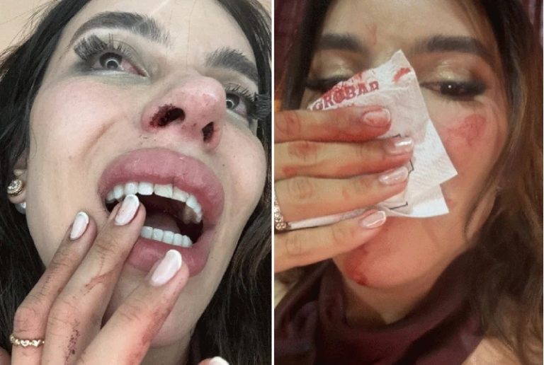 Polícia investiga agressão contra influenciadora Lea Reis em bar de Balsas