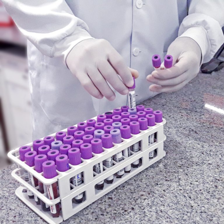 Setembro Vermelho: como exames de sangue podem antecipar a identificação de riscos ao coração